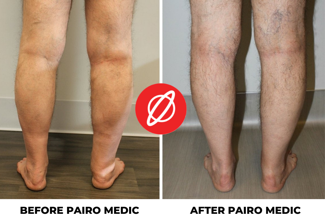 Pairo Medic™ - Kompressionssocken 20-30 mmHg für Männer & Frauen {3 Paar zum Preis von 1}