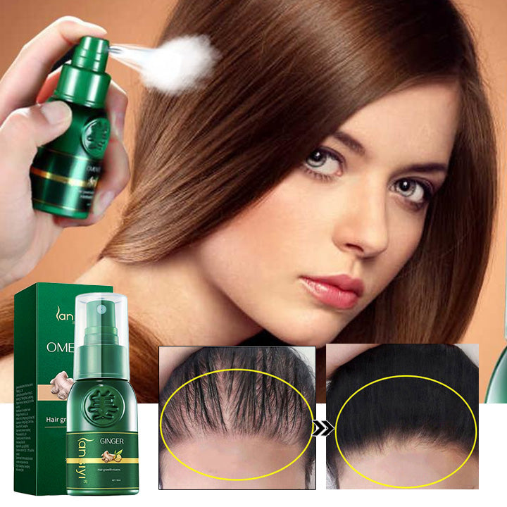 1+1 GRATIS | HairRegrow™ | Haarwachstumsspray – Trendiez