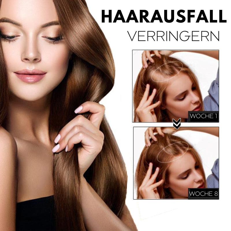 1+1 GRATIS | HairRegrow™ | Haarwachstumsspray